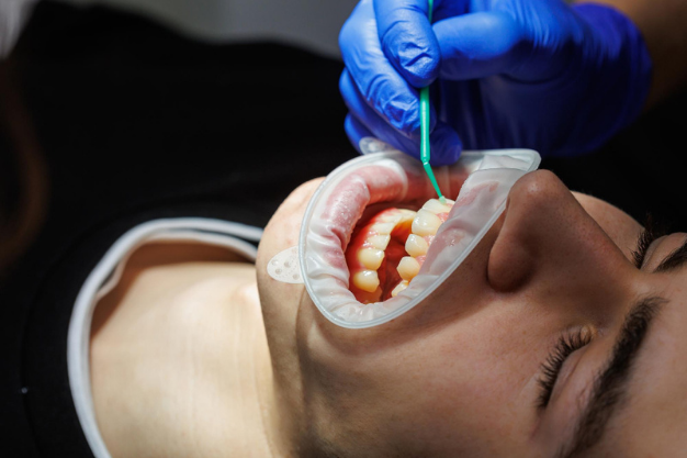 periodontoloji-dis-eti-tedavileri-2.png